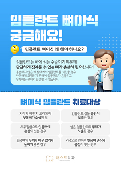 임플란트 뼈이식 궁금해요!